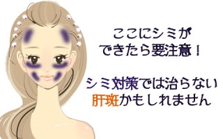 肝斑はスキンケアじゃ治らない？シミと似てる肝斑の見分け方＆改善法